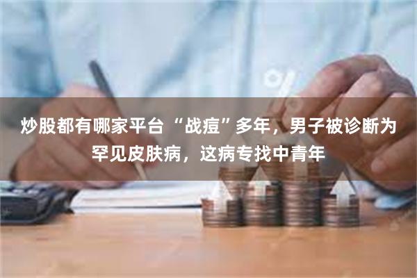 炒股都有哪家平台 “战痘”多年，男子被诊断为罕见皮肤病，这病专找中青年